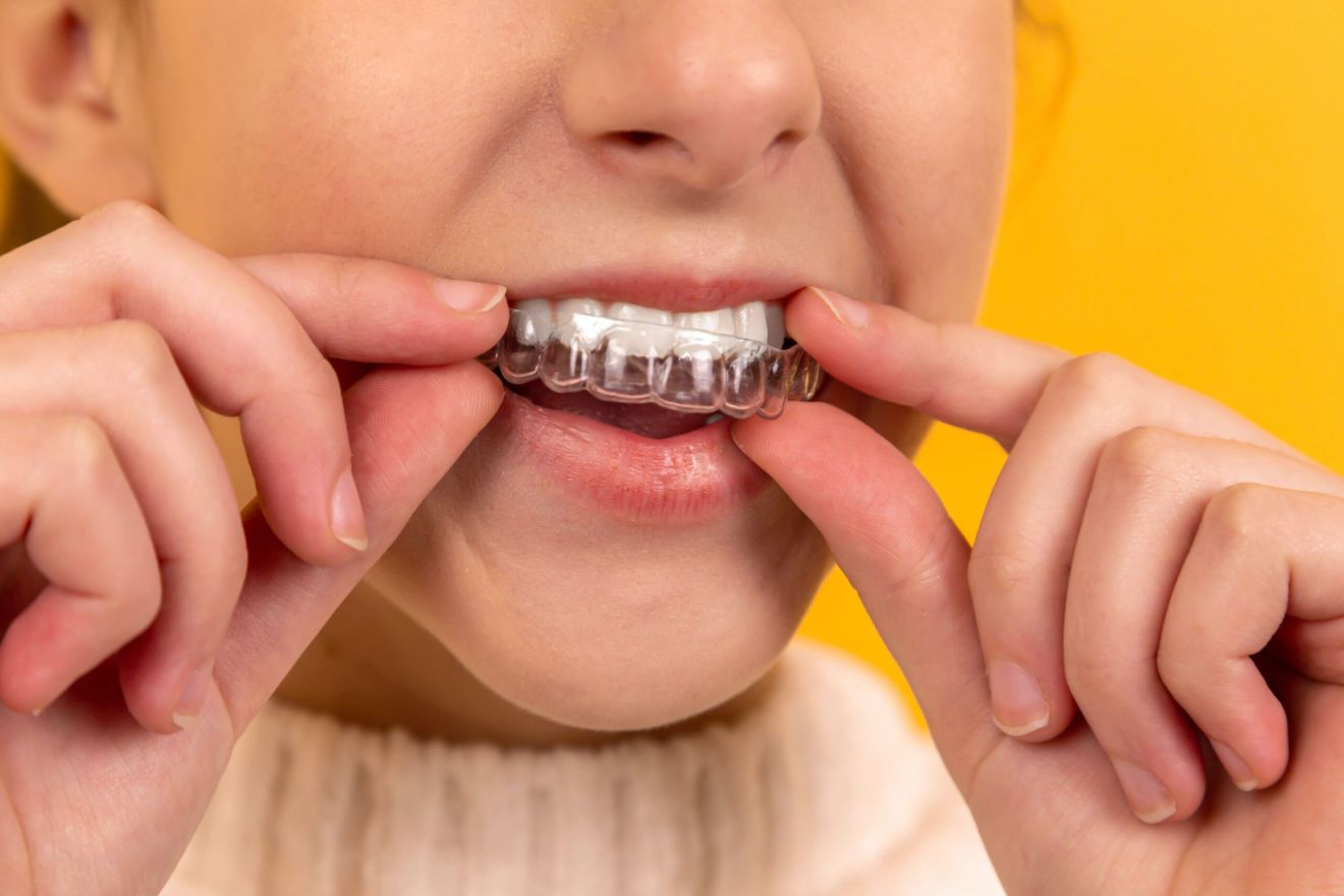 invisalign für kindern
